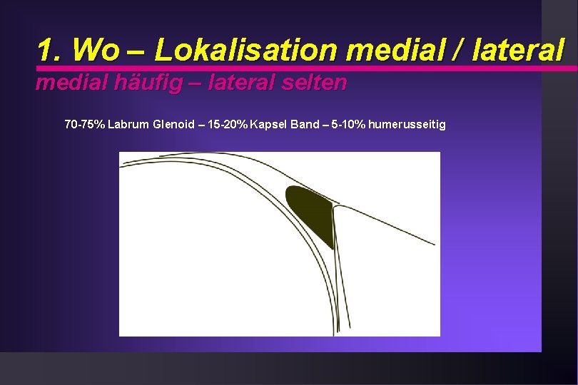 1. Wo – Lokalisation medial / lateral medial häufig – lateral selten 70 -75%