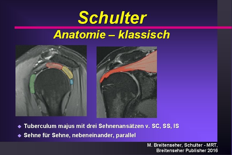 Schulter Anatomie – klassisch u Tuberculum majus mit drei Sehnenansätzen v. SC, SS, IS