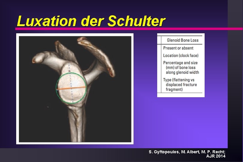 Luxation der Schulter S. Gyftopoulos, M. Albert, M. P. Recht; AJR 2014 