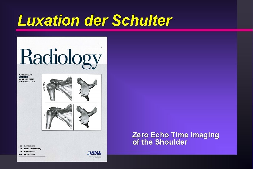 Luxation der Schulter Zero Echo Time Imaging of the Shoulder 
