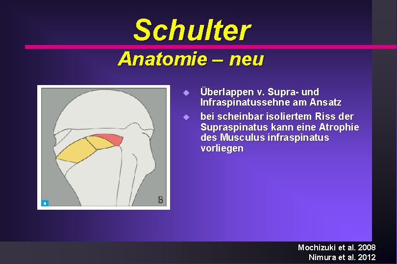 Schulter Anatomie – neu u u Überlappen v. Supra- und Infraspinatussehne am Ansatz bei