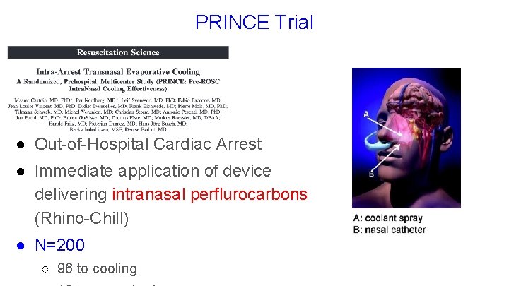 PRINCE Trial ● Out-of-Hospital Cardiac Arrest ● Immediate application of device delivering intranasal perflurocarbons