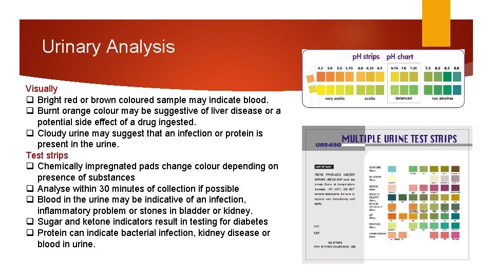 Urinary Analysis Visually q Bright red or brown coloured sample may indicate blood. q