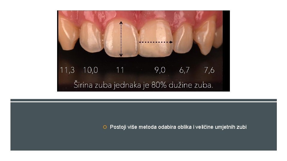  Postoji više metoda odabira oblika i veličine umjetnih zubi 
