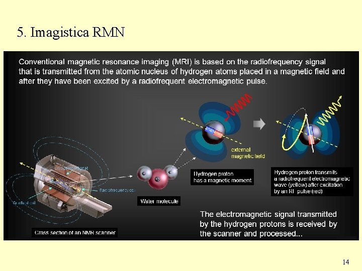 5. Imagistica RMN 14 