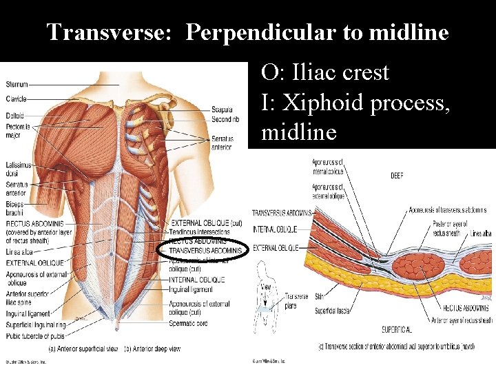 Transverse: Perpendicular to midline O: Iliac crest I: Xiphoid process, midline 