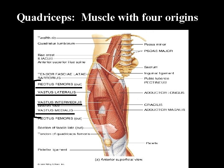 Quadriceps: Muscle with four origins 