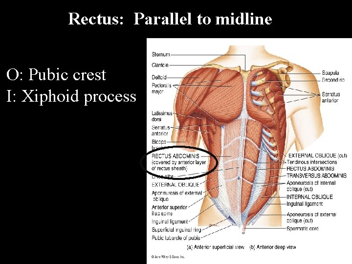 Rectus: Parallel to midline O: Pubic crest I: Xiphoid process 
