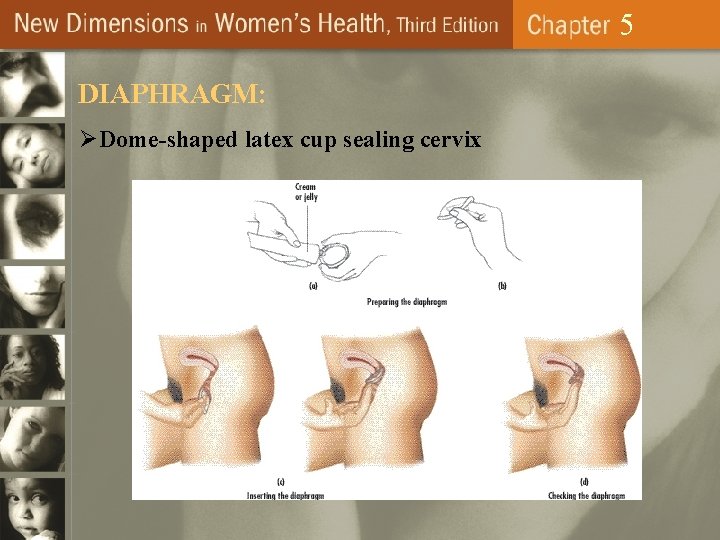 5 DIAPHRAGM: ØDome-shaped latex cup sealing cervix 