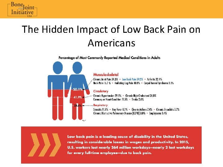 The Hidden Impact of Low Back Pain on Americans 