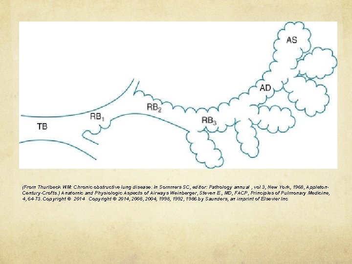 (From Thurlbeck WM: Chronic obstructive lung disease. In Sommers SC, editor: Pathology annual ,
