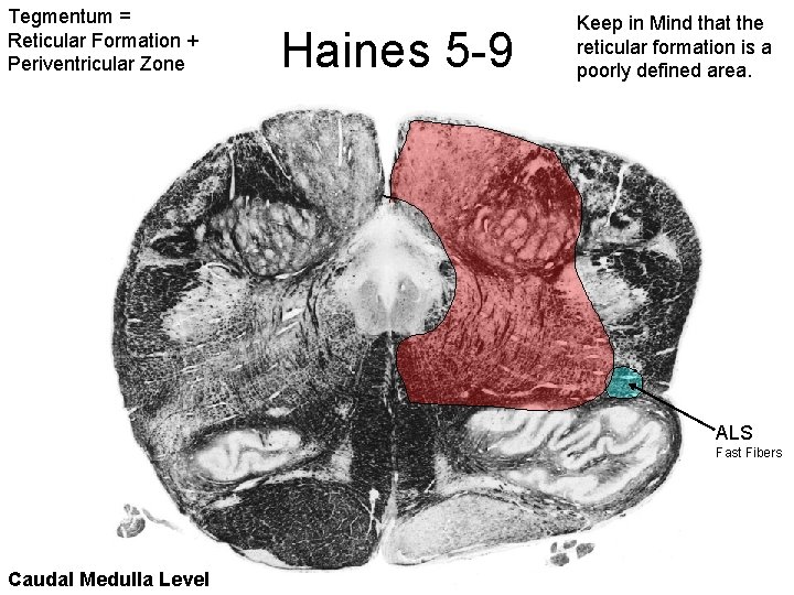 Tegmentum = Reticular Formation + Periventricular Zone Haines 5 -9 Keep in Mind that