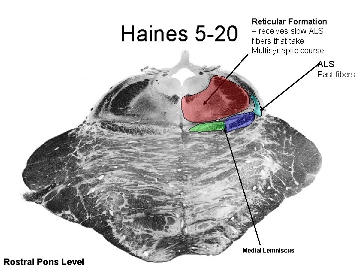 Haines 5 -20 Reticular Formation – receives slow ALS fibers that take Multisynaptic course