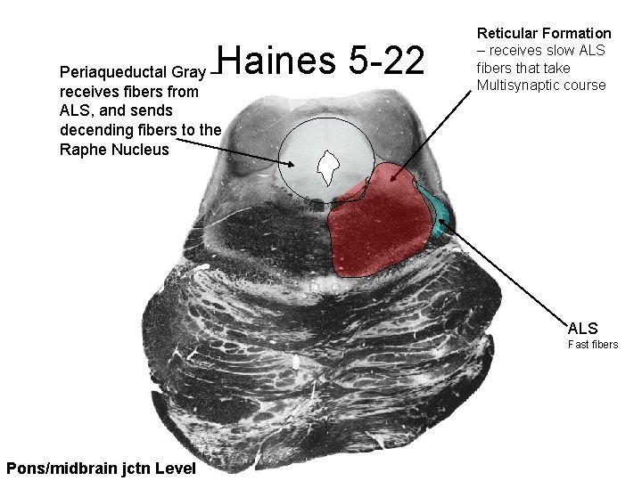 Haines 5 -22 Periaqueductal Gray – receives fibers from ALS, and sends decending fibers