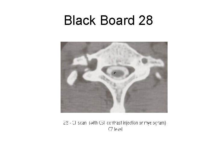 Black Board 28 