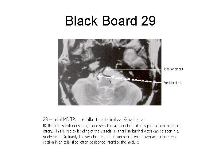 Black Board 29 