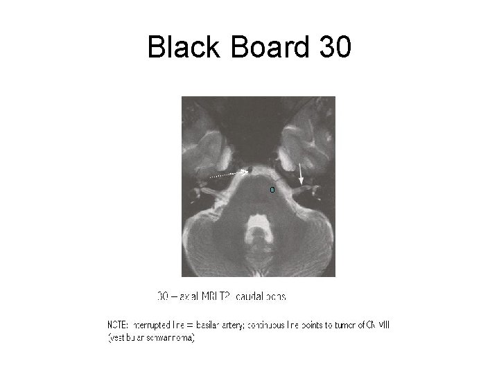 Black Board 30 