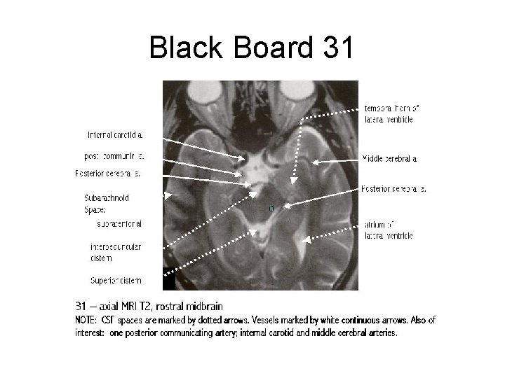 Black Board 31 