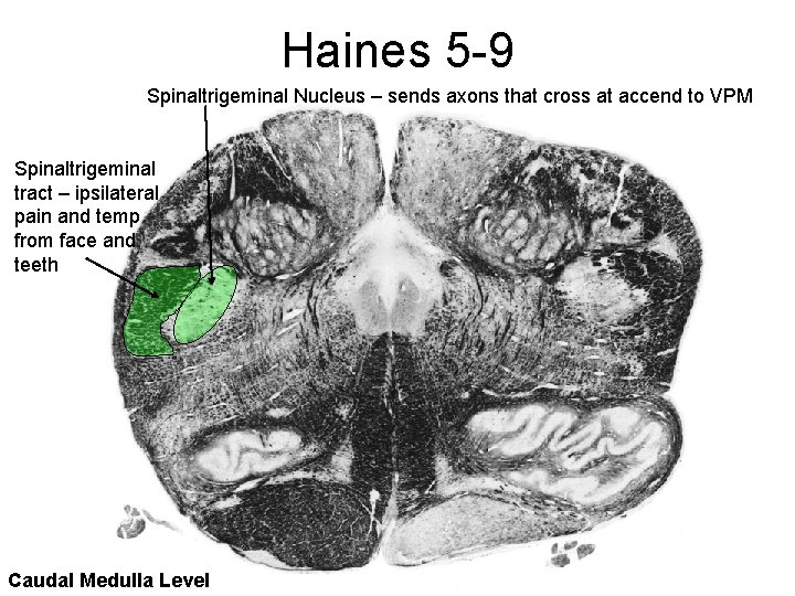 Haines 5 -9 Spinaltrigeminal Nucleus – sends axons that cross at accend to VPM