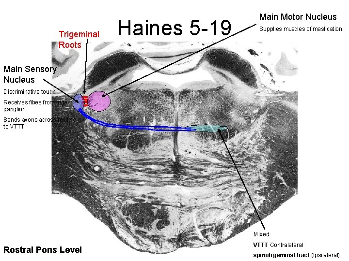 Trigeminal Roots Haines 5 -19 Main Motor Nucleus Supplies muscles of mastication Main Sensory