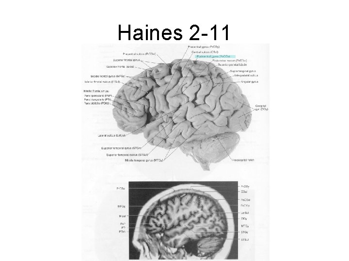 Haines 2 -11 