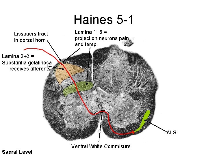 Haines 5 -1 Lissauers tract in dorsal horn Lamina 1+5 = projection neurons pain