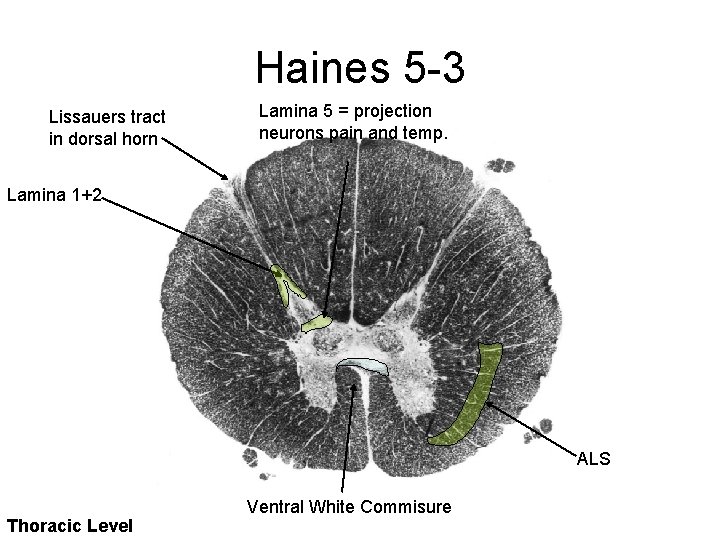 Haines 5 -3 Lissauers tract in dorsal horn Lamina 5 = projection neurons pain