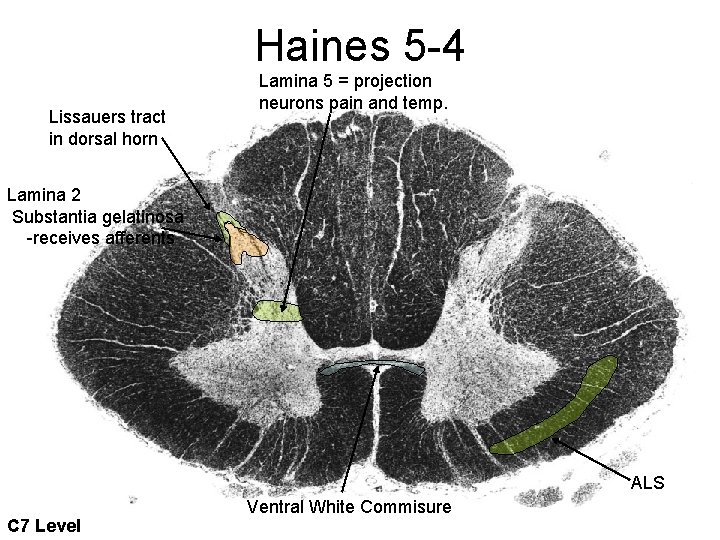 Haines 5 -4 Lissauers tract in dorsal horn Lamina 5 = projection neurons pain