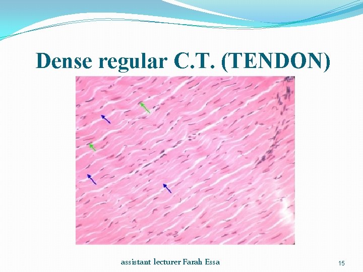 Dense regular C. T. (TENDON) assistant lecturer Farah Essa 15 