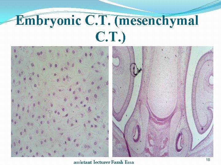 Embryonic C. T. (mesenchymal C. T. ) assistant lecturer Farah Essa 18 