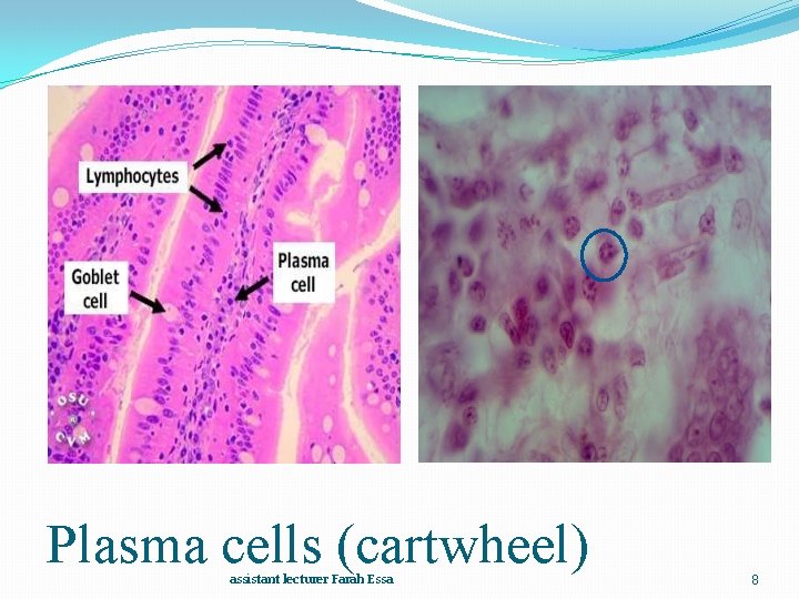 Plasma cells (cartwheel) assistant lecturer Farah Essa 8 