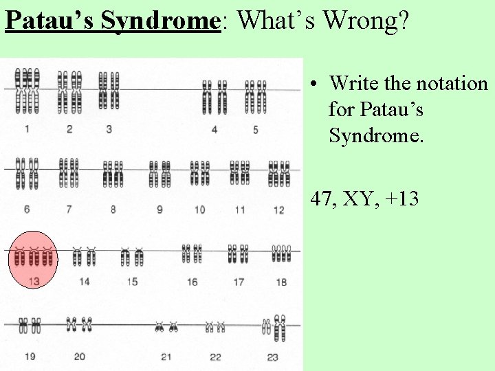 Patau’s Syndrome: What’s Wrong? • Write the notation for Patau’s Syndrome. 47, XY, +13