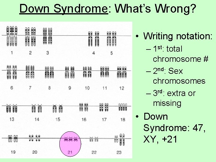 Down Syndrome: What’s Wrong? • Writing notation: – 1 st: total chromosome # –