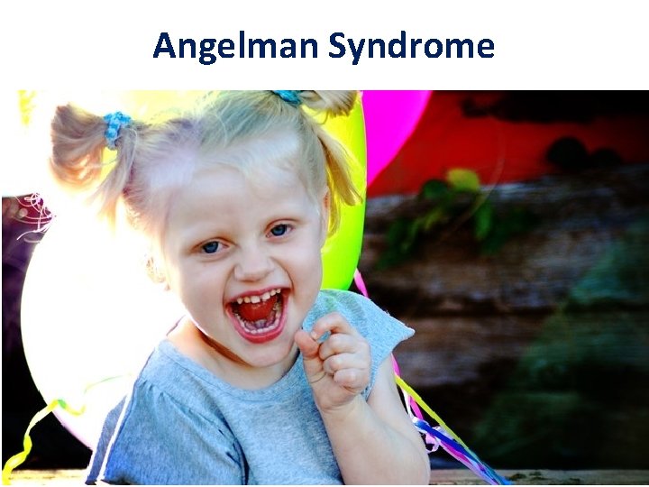 Angelman Syndrome 