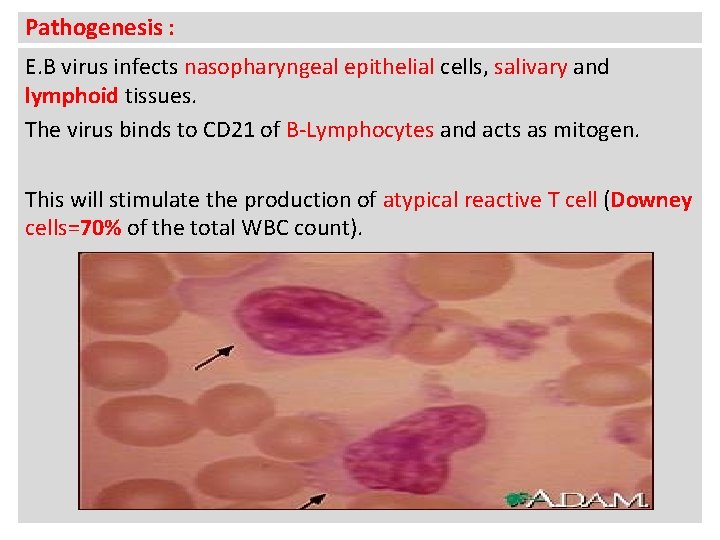 Pathogenesis : E. B virus infects nasopharyngeal epithelial cells, salivary and lymphoid tissues. The