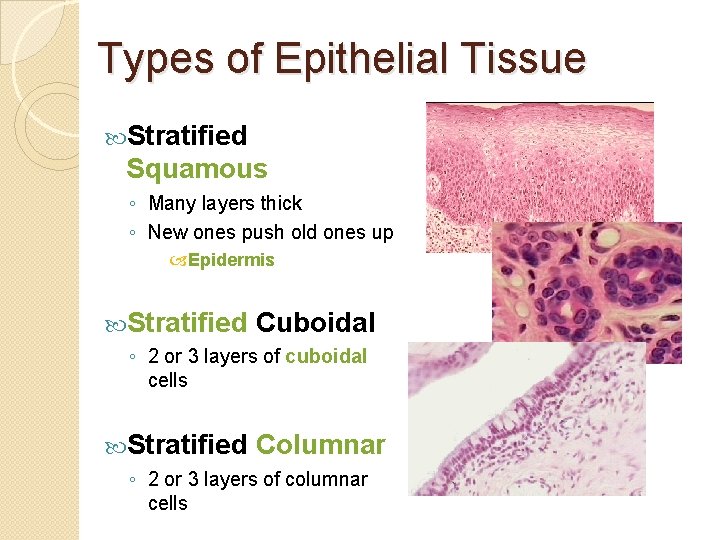 Types of Epithelial Tissue Stratified Squamous ◦ Many layers thick ◦ New ones push