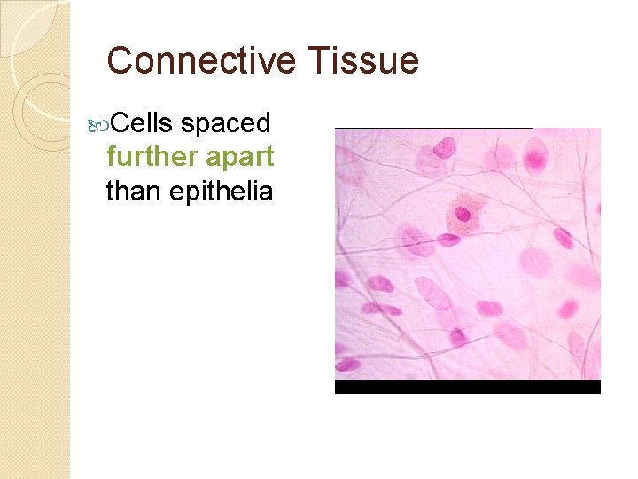 Connective Tissue Cells spaced further apart than epithelia 