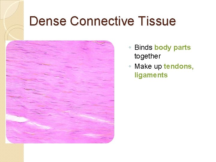Dense Connective Tissue ◦ Binds body parts together ◦ Make up tendons, ligaments 