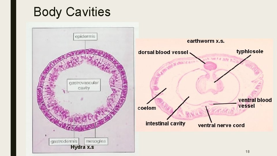 Body Cavities Hydra x. s 18 