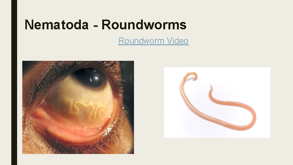 Nematoda - Roundworms Roundworm Video 