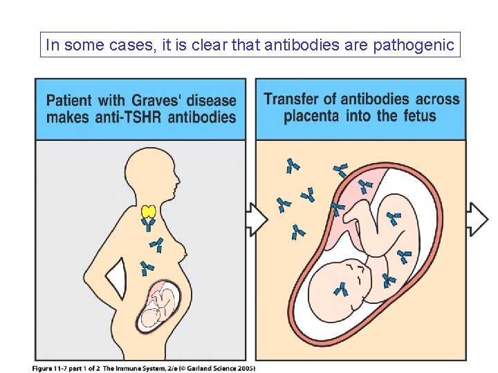 In some cases, it is clear that antibodies are pathogenic 