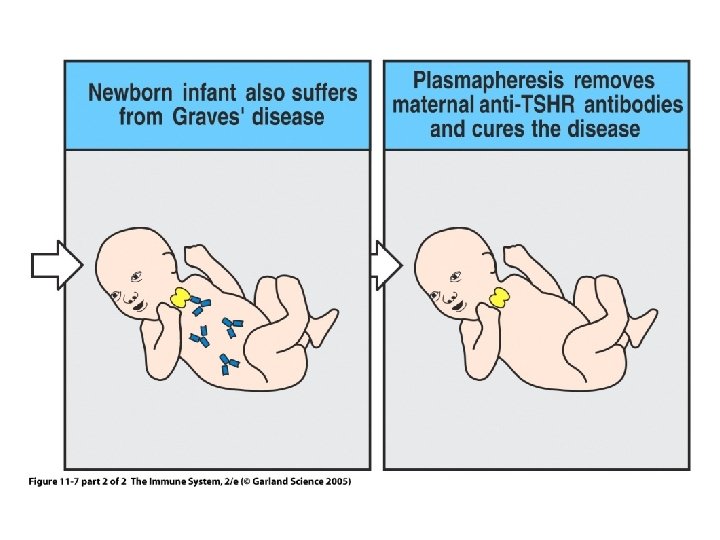 Figure 11 -7 part 2 of 2 