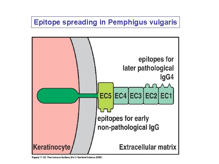 Epitope spreading in Pemphigus vulgaris 