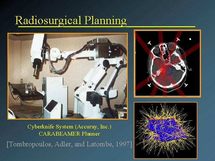 Radiosurgical Planning Cyberknife System (Accuray, Inc. ) CARABEAMER Planner [Tombropoulos, Adler, and Latombe, 1997]