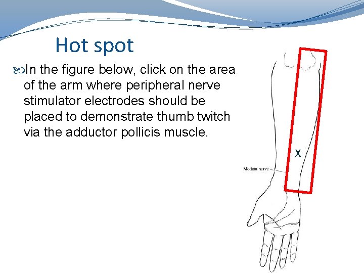 Hot Spot Questions Hot spot In the figure below, click on the area of