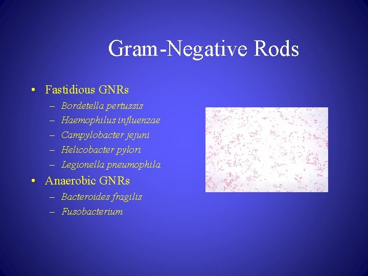 Gram-Negative Rods • Fastidious GNRs – – – Bordetella pertussis Haemophilus influenzae Campylobacter jejuni