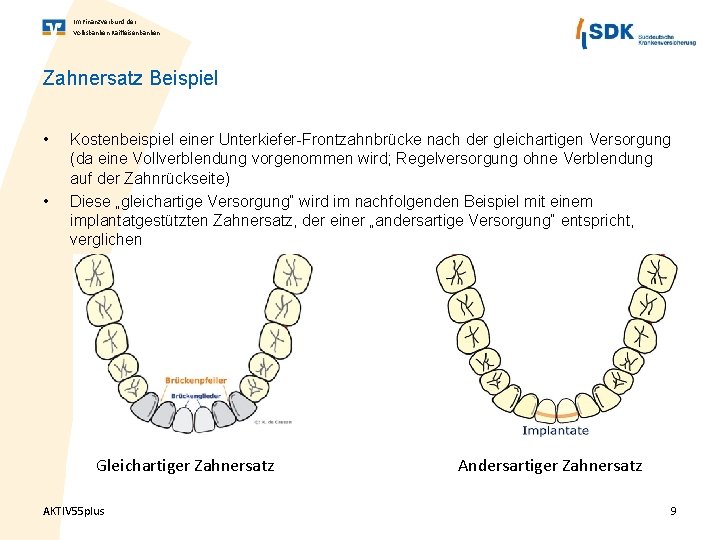 Im Finanz. Verbund der Volksbanken Raiffeisenbanken Zahnersatz Beispiel • • Kostenbeispiel einer Unterkiefer-Frontzahnbrücke nach