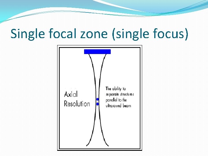 Single focal zone (single focus) 