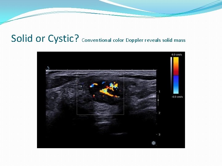 Solid or Cystic? Conventional color Doppler reveals solid mass 