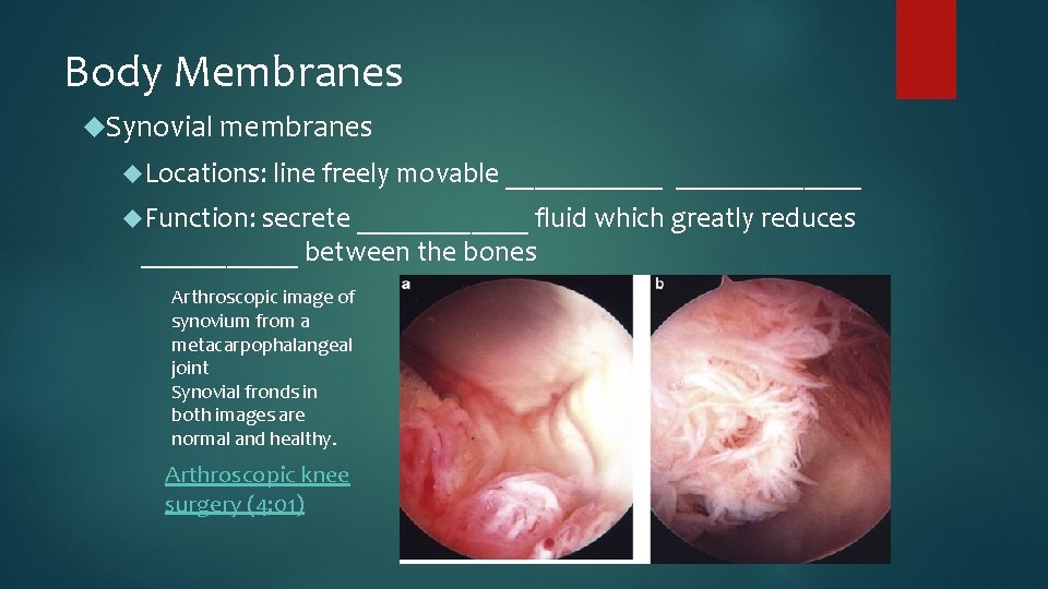 Body Membranes Synovial membranes Locations: line freely movable _____________ Function: secrete ______ fluid which